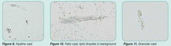 تحليل البول Urinalysis الدليل الطبي Altebby