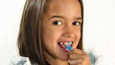 دراسة تحذر: إعوجاج أسنان الطفل علامة على سوء التغذية