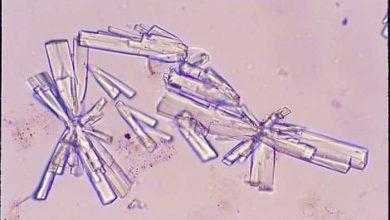 تحليل الصوديوم (Na) في البول