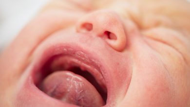 اللسان المربوط عند الرضع