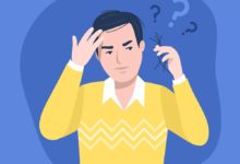 علاجات داء الثعلبة