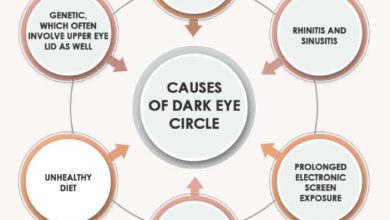 الهالات السوداء