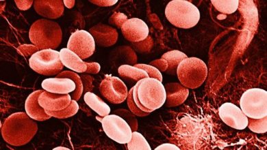 أنيميا البحر المتوسط