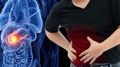 سرطان البنكرياس