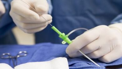 إجراء قسطرة القلب