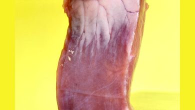 مادة لاصقة للأنسجة