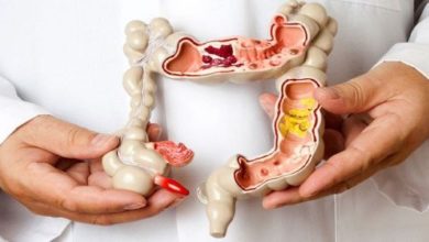 مرض التهاب الأمعاء