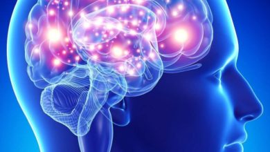 تشخيص السكتة الدماغية