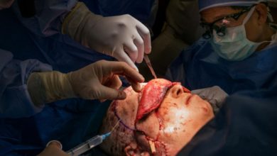 زرع وجه وعين